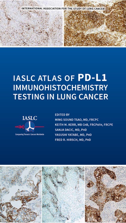 IASLC Atlas of PD-L1 Testing in Lung Cancer