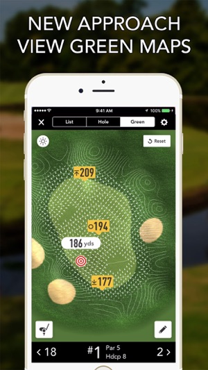 golflogix apple watch