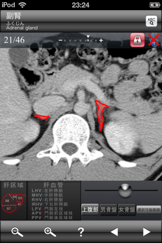 断面図ウォーカー腹部CT screenshot 4