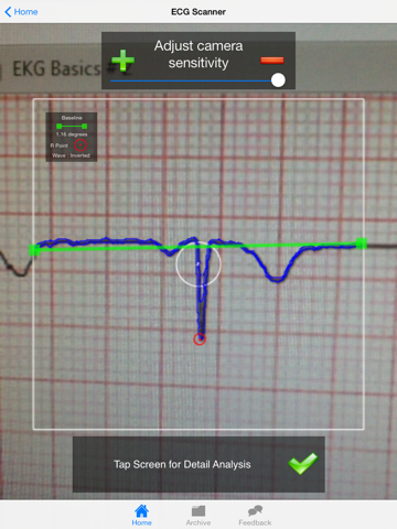 Doctor ECG guide & calculator - náhled