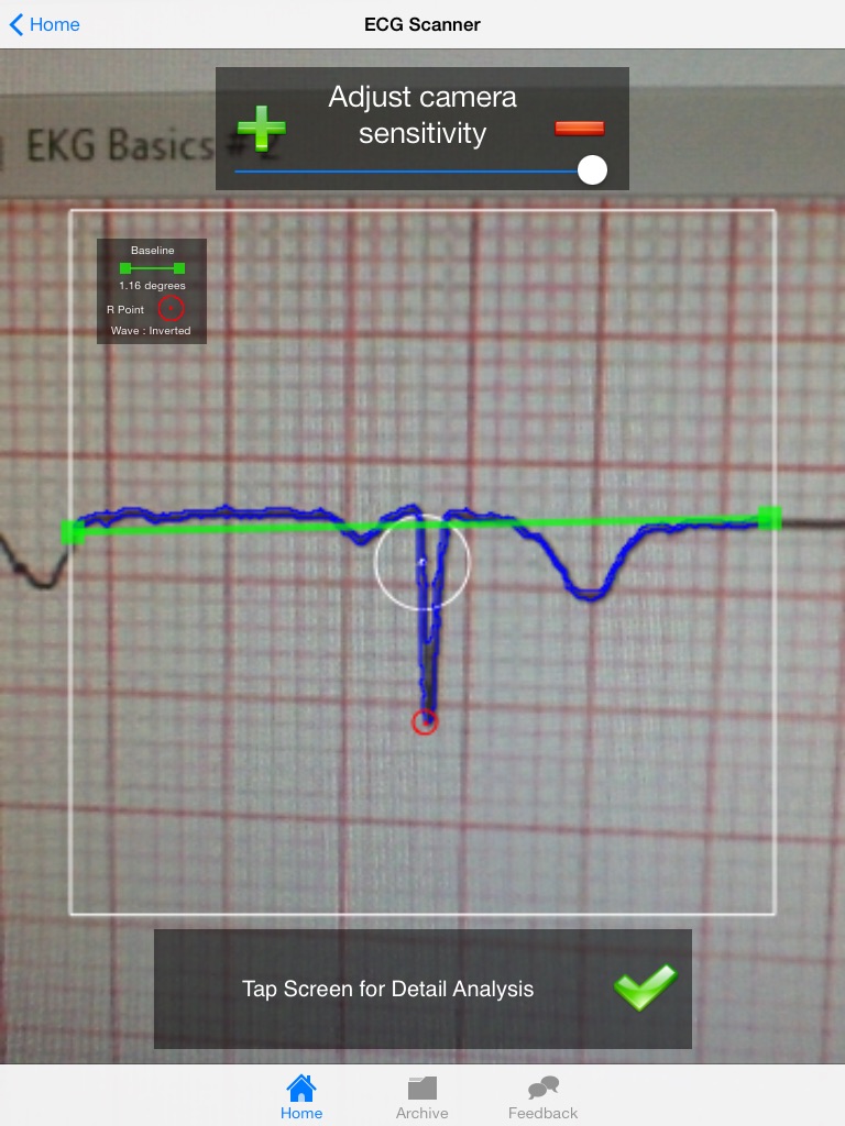 Doctor ECG guide & calculator screenshot 2