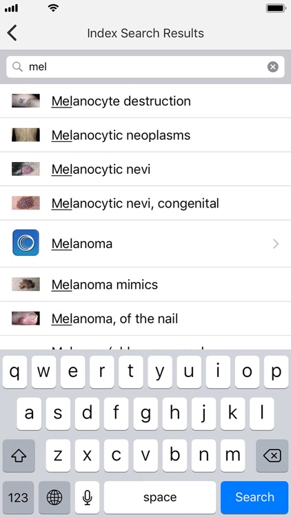 Dermatology DDx screenshot-4