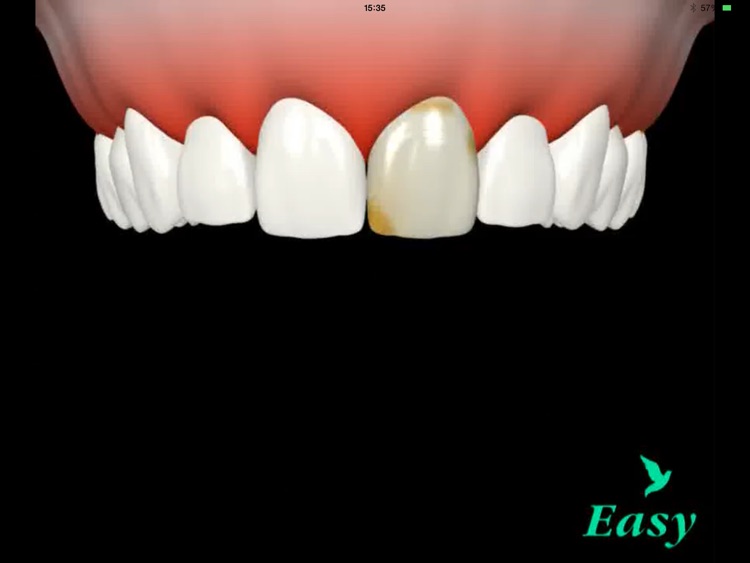 EasyDental View screenshot-3