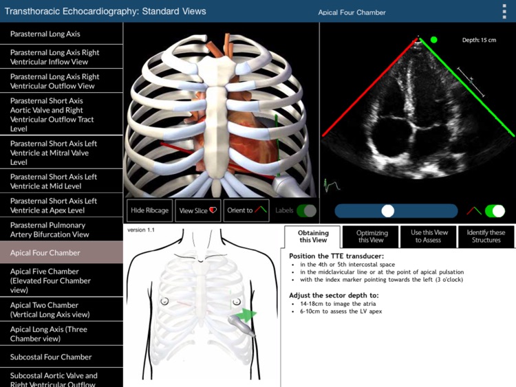 TTE Standard Views by University Health Network