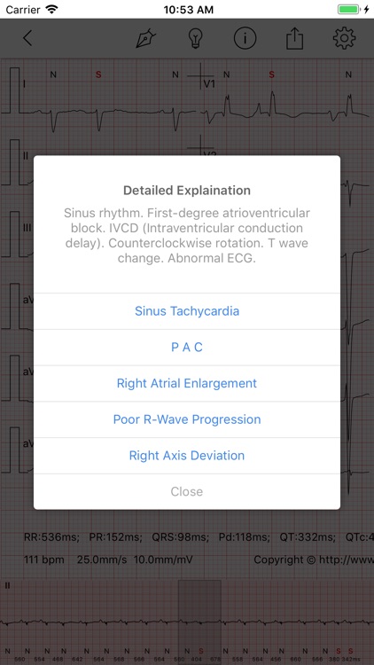ECG - Cases for CME & EMT screenshot-3