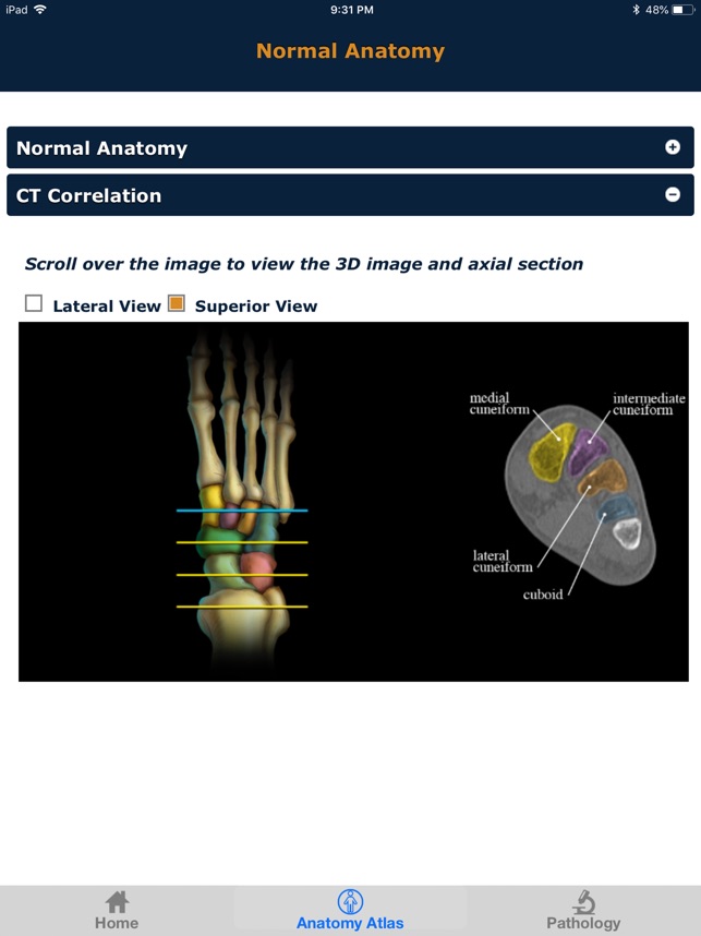 CTisus: CT of the Foot(圖5)-速報App