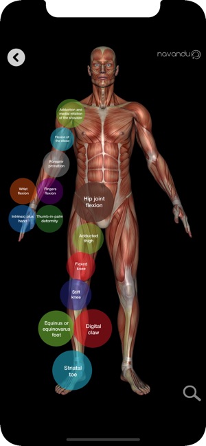 Localización muscular(圖2)-速報App