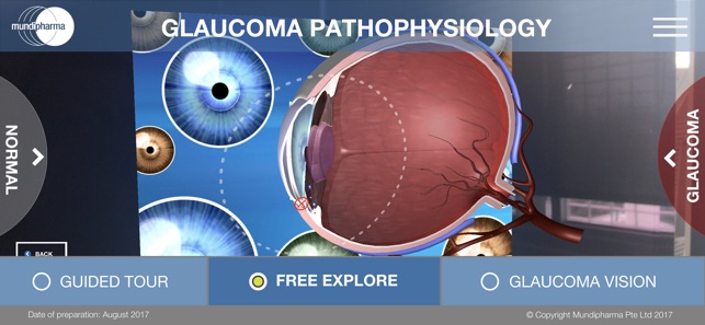 Glaucoma Education(圖5)-速報App