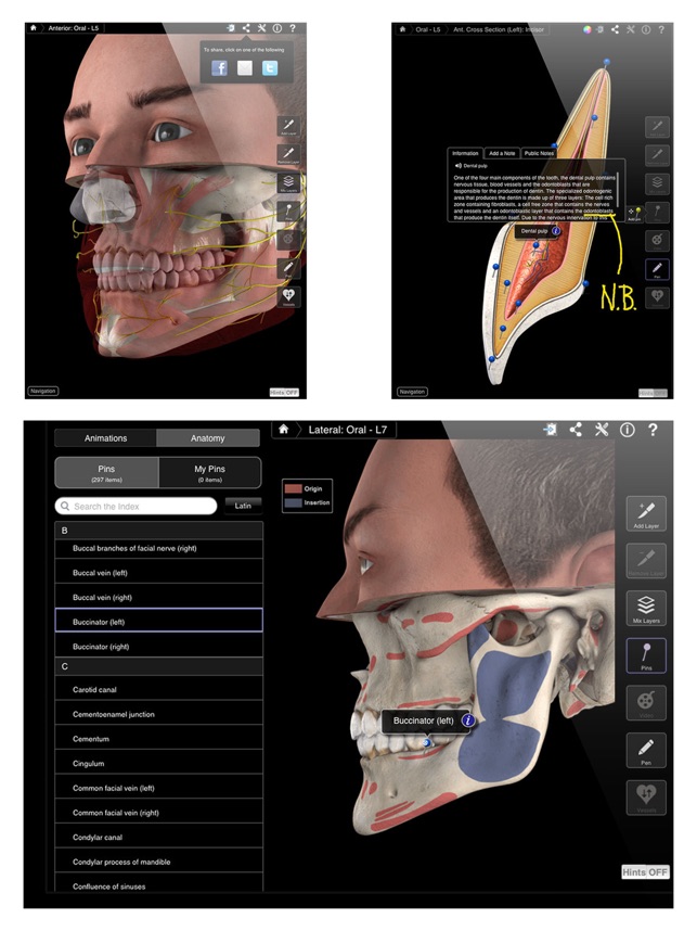 Dental Patient Education(圖3)-速報App