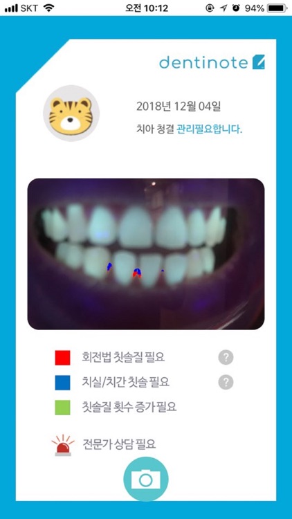 덴티노트(Dentinote)