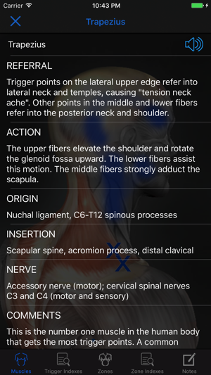 Muscle Trigger Points: Guide & Reference(圖2)-速報App