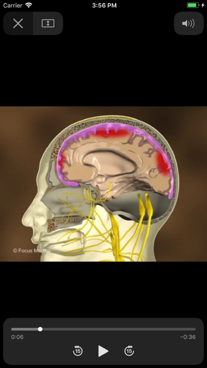 NEUROANATOMY - Digital Anatomy screenshot-4