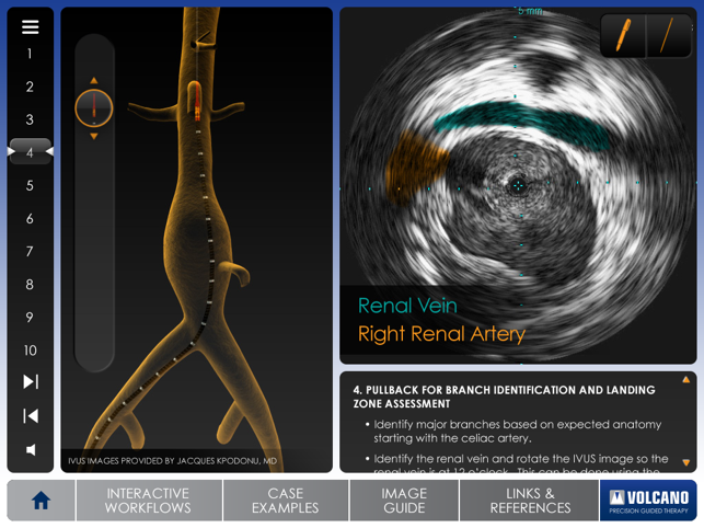 Aortic IVUS(圖2)-速報App