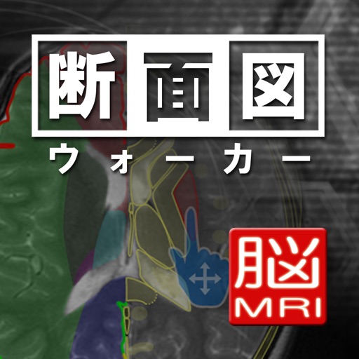 断面図ウォーカー脳MRI by Ryo Matsuda