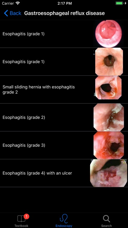 ENDO3® Gastrointestinal Atlas