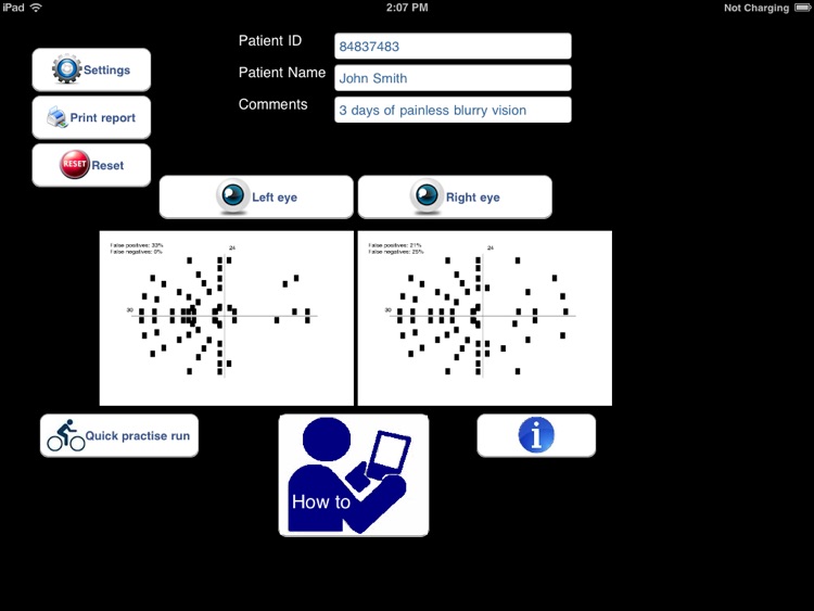 visualFields easy