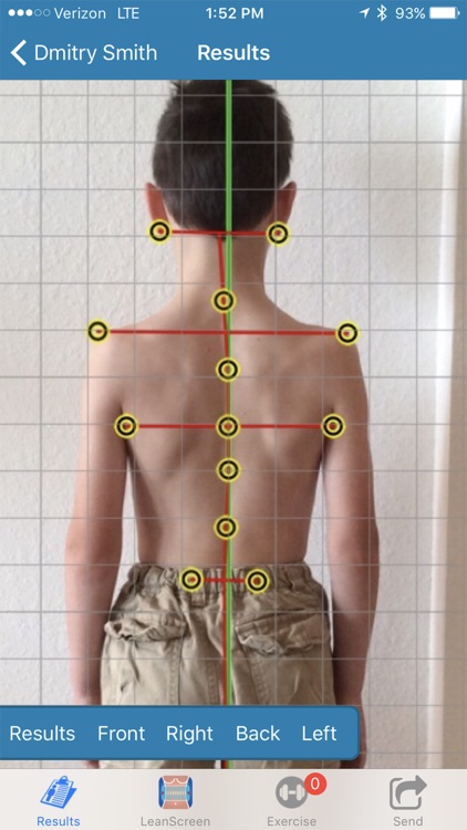 PostureScreen: Posture, Movement, Body Composition