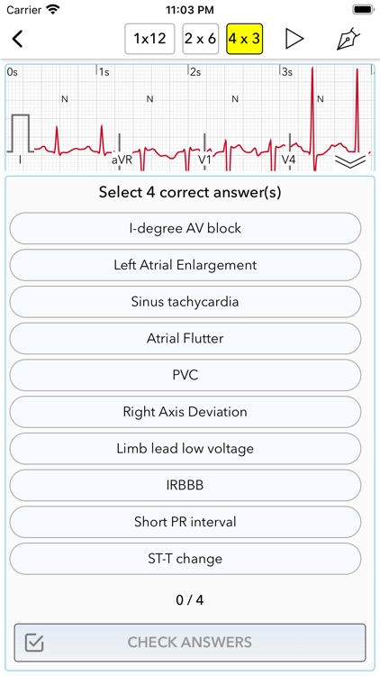 ECG Test Pro for Doctors screenshot-6