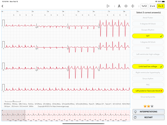 ECG Test Pro for Doctors screenshot 3