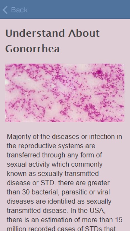 Symptoms Of Gonorrhea
