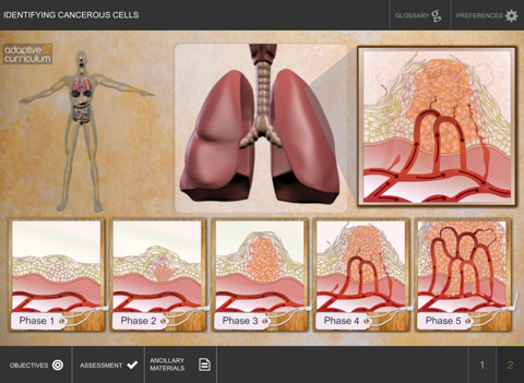 Identifying Cancerous Cells screenshot 3