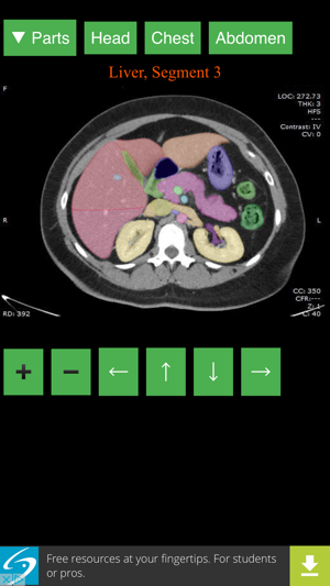 Anatomy on Radiology CT(圖1)-速報App