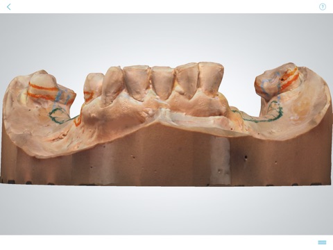 3Shape Dental System™ screenshot 2