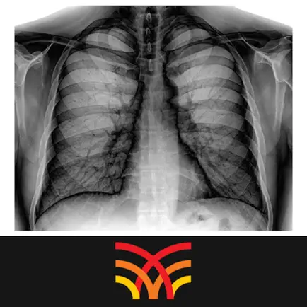 Chest Radiographs Читы