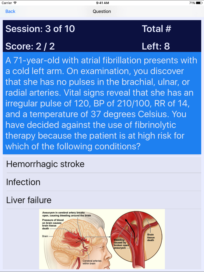 Progressive Care Nursing PCCN Review