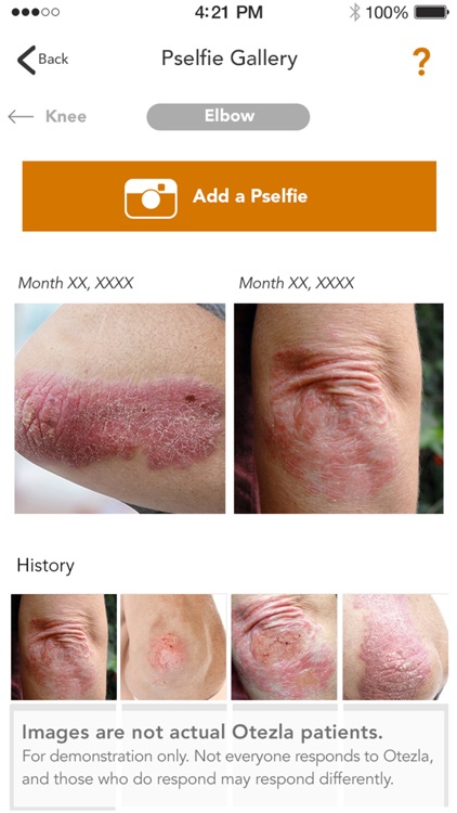GOtezla - Helping you get started screenshot-4