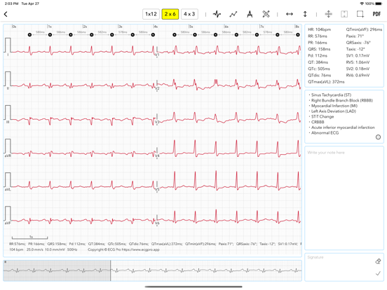 ECG Pro for Doctors screenshot 2