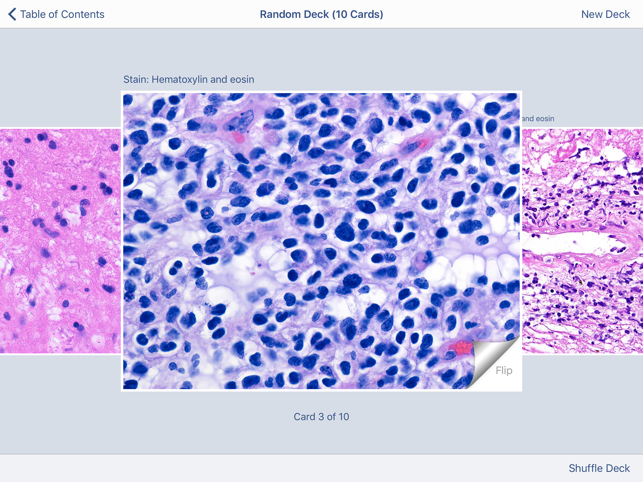 Johns Hopkins Atlas of Surgical Neuropathology(圖5)-速報App