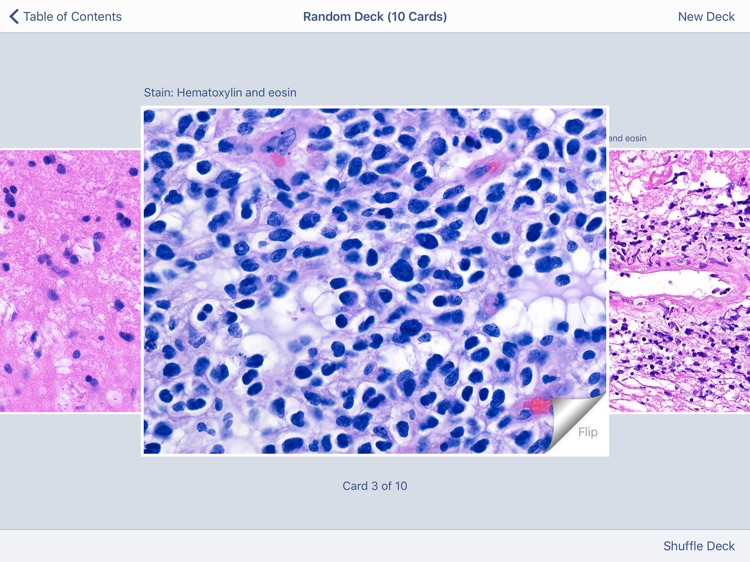 Johns Hopkins Atlas of Surgical Neuropathology screenshot-4