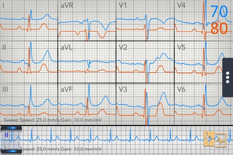 Change Healthcare ECG Mobile screenshot 3