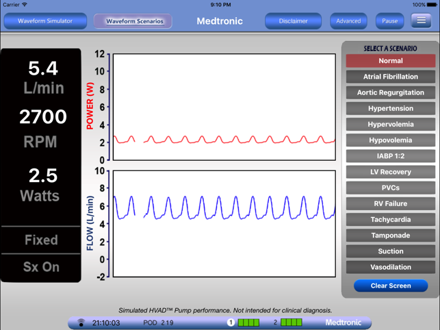 HVAD Waveforms(圖4)-速報App