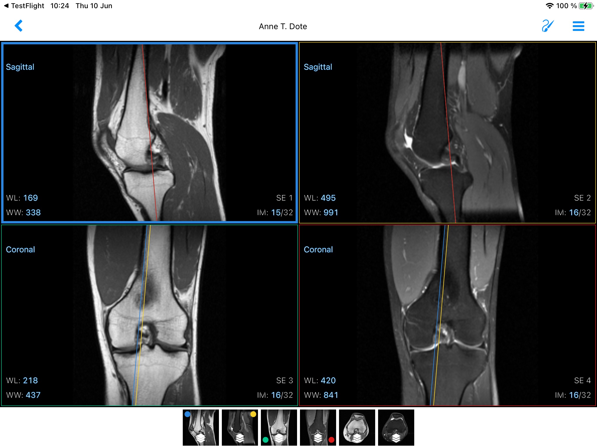 IDV - IMAIOS DICOM Viewer screenshot 3