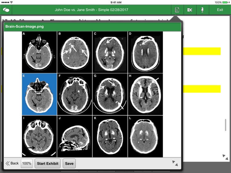 LiveLitigation iPad edition