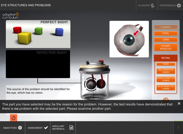 Eye Structures and Problems(圖3)-速報App