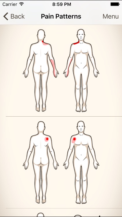 Clinical Pattern Recognition: Shoulder Pain