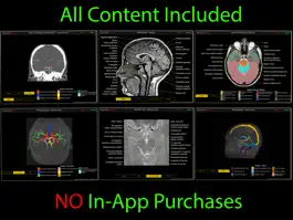 Game screenshot NeuroRad apk