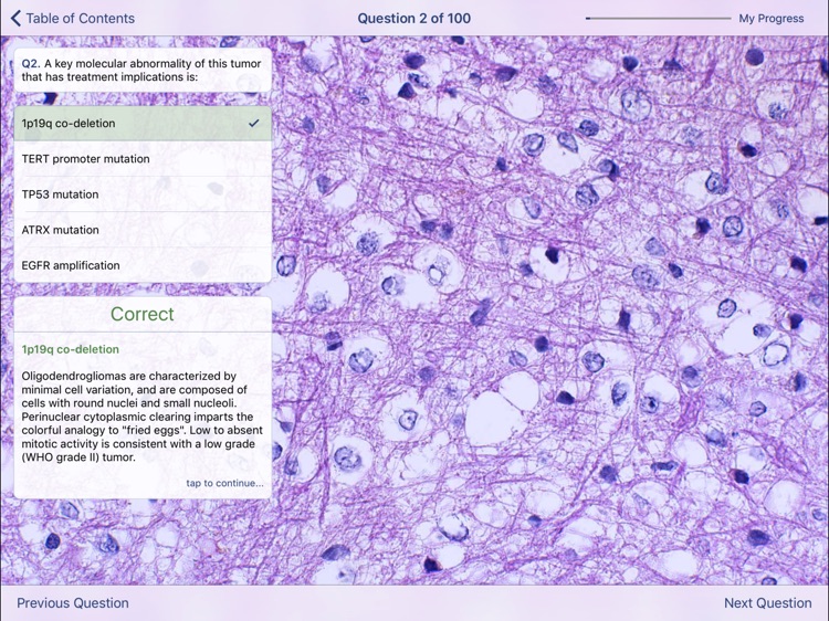 Johns Hopkins Atlas of Surgical Neuropathology screenshot-3