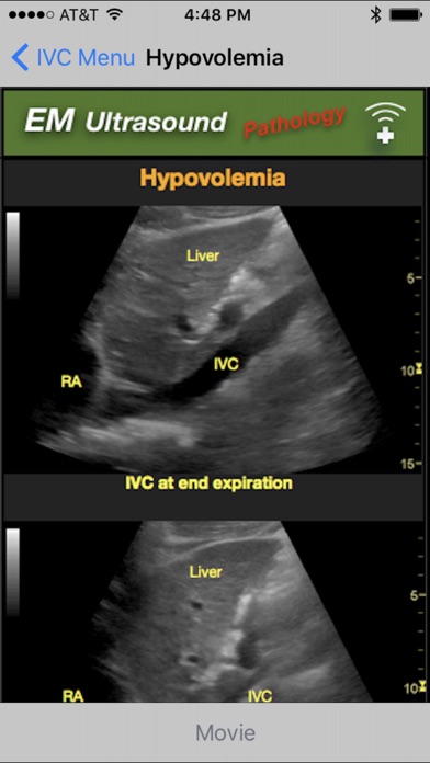 Emergency Medicine Ultrasoundのおすすめ画像4