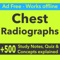 Chest Radiographs Exam Prep- Study Notes & Quizzes