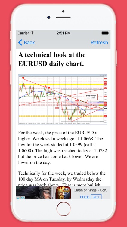 Forex Technical Analysis Today By Hai Nam Trinh - 