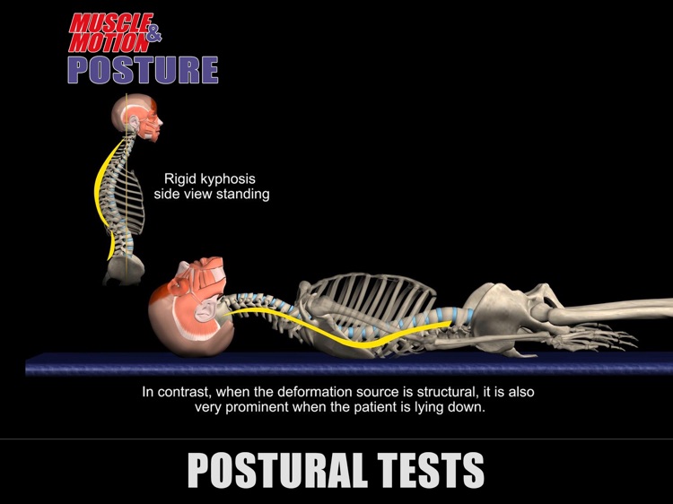 Muscle and Motion - Posture screenshot-4