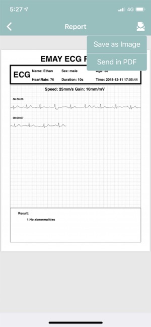 EMAY Portable ECG Monitor(圖4)-速報App