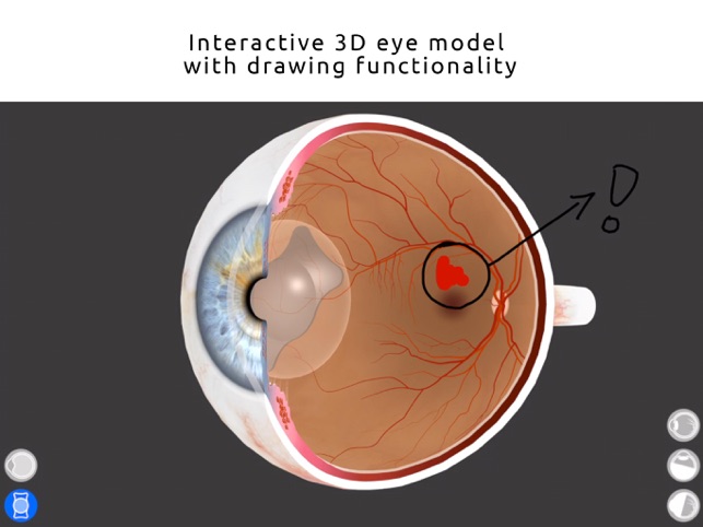 Easy Eye(圖1)-速報App