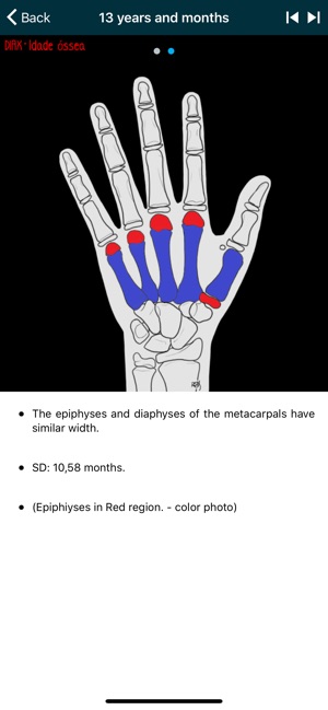 DIAX - Idade Óssea(圖8)-速報App