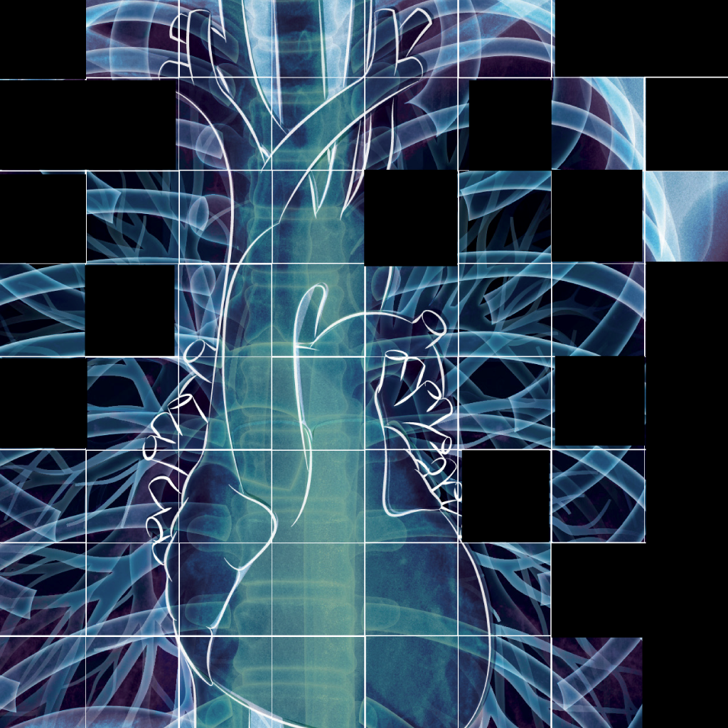 Chest X-ray Interpretation App Icon