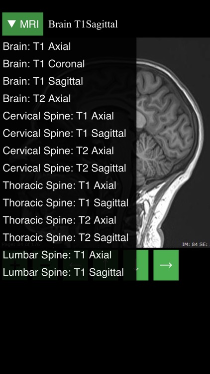 MRI Viewer screenshot-4